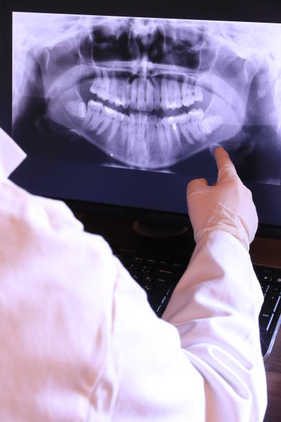 Best Emergency Treatment for Oral Infections in Somerset, KY
